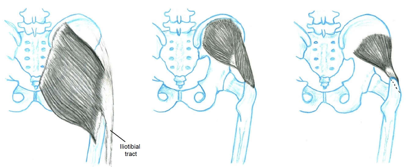 Muscle Group 10 - A Figure